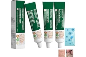 HAWEWE Crème Antifongique à Base De Plantes Pour Les Mains Et Les Pieds, Crème à Base De Plantes Pour éliminer Les Champignons Des Pieds, Crème Pour Les Champignons Des Ongles Des Pieds (3Pcs)