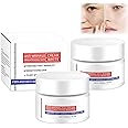 Aobenz Whitening and Freckle Removing Essence, Aobenz Spot Remover for Face, Niacinamide Cream Anti Wrinkle Anti Aging Face Lift Tighten Reduce Finelines Moisturing Whitening Cream (2)