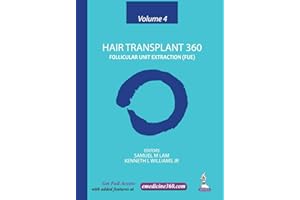 Hair Transplant 360: Volume 4: Follicular Unit Extraction