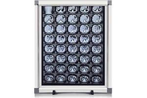 GMBAYUE Professionelle Röntgenfilm-Leuchtbox, Dia Viewer Leuchtkasten, Laborausrüstung, 0-100 % Einstellbare Helligkeit, Keine Schatten für Den Einsatz in Kliniken, Krankenhäusern und Laboren(16x19x03in/41x47