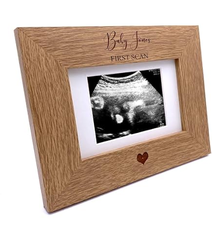 Personalized Baby Scan Photo Frame - Multi Aperture Holds 3 Photos, 16x8 Inch Wall Mount