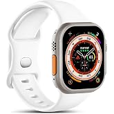 Microsonic Apple Watch Series 10 46mm Kordon Harmony Edition (Apple Watch Series 10 46mm ile Uyumlu Kordon, Akıllı Saat Kayış