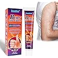 FDTY Burn Gel | Burn Care Cream,20g Scar Removal Cream, Burn Ointment for Temporary Relief of Minor Burns, Cuts