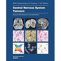 WHO Classification of Tumours of Haematopoietic and Lymphoid