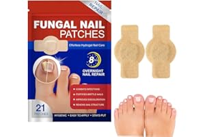 GXGM 21 Pezzi Cerotti Per Micosi Delle Unghie - Cerotti Per Micosi Delle Unghie Dei Piedi Extra Forti, micosi unghie piede,trosyd micosi unghie piedi.