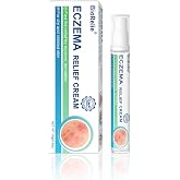 Eczema Cream 18g,Anti Itch Cream,Soothing for Dry and Irritated Skin | Relieves itching and redness, no sticky residue left