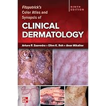 Buy Lookingbill and Marks' Principles of Dermatology -6E Book