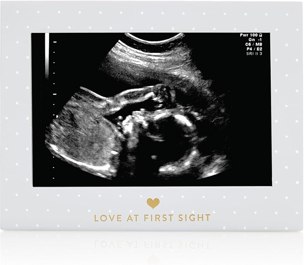 Little Blossoms Sonogram Resim Çerçevesi Hamilelik Hatırası, Yakında Kız Bebek veya Erkek Bebek Olacak Cinsiyetsiz Çocuk Odası Dekoru