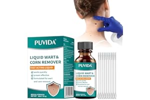 ZOILLGU Kit Eliminar Verrugas 30ml - Elimina Suavemente Verrugas de Manos y Cuerpo