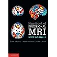 Handbook of Functional MRI Data Analysis