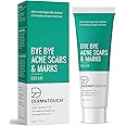 AM Creation DERMATOUCH Bye Bye Acne Scars & Marks Cream || Acne Scars Corrector || Formulated Specially to Address Scars & Marks || Gives Even Skin Tone || Suitable For All Skin Types - 30G