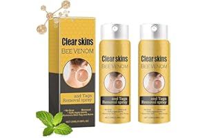 BAGALQIO Bee Venom Skin Tag Remover Spray,Tag Recede Bee Venom Spray,Bee Venom Wart and Tags Removal Treatment Spray,Smooth Skin Gentle Warts Removal Suitable for Men and Women（2Pcs）