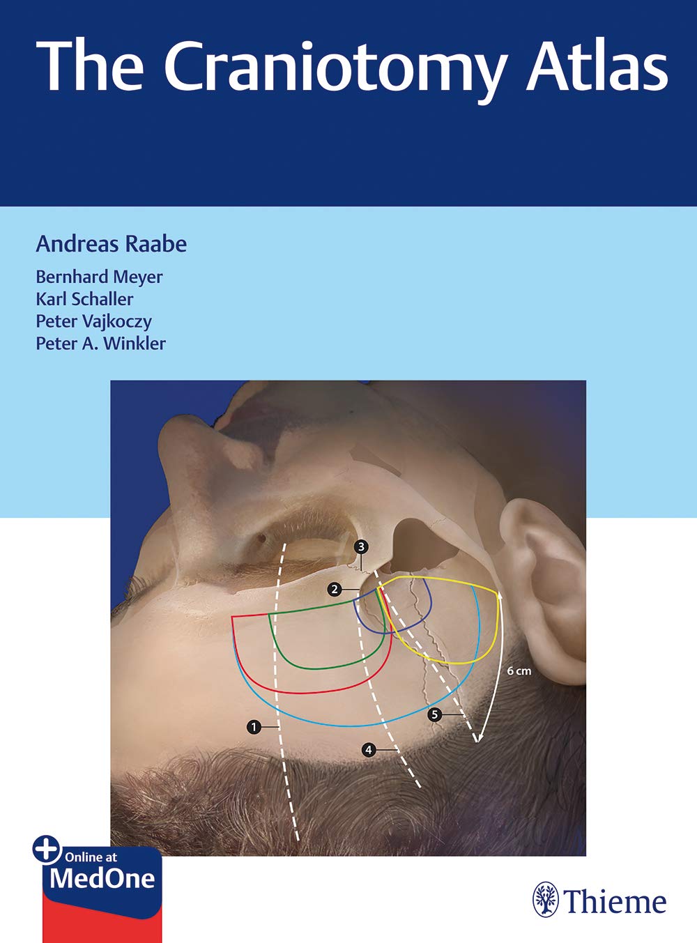 Pdf Telecharger The Craniotomy Atlas By Andreas Raabe Epub Ebook Livrespdfcom Buyers Guide It