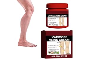 Varicose Veins Cream benvårdsbalsam – kräm mot åderbråck och åderbråck, naturlig benvård, förbättrar blodcirkulationen, ger n