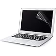 FEDUS Polycarbonate Clear Hd Full Screen Protector Guard Scratch Protector for 15.6 Inch Laptop