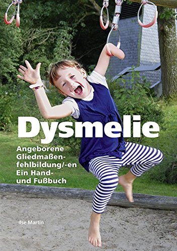 Preisvergleich Produktbild Dysmelie Angeborene Gliedmaßenfehlbildung / -en: Ein Hand- und Fußbuch