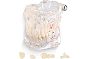 Uadme Fantoma Dental, Modelo de Demostración Dental, Modelos de Dentadura Articulada, Modelo de Dientes Desmontable, para Enseñanza Dental, Cuidado Bucal