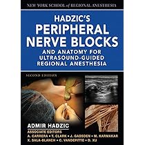 Hadzic's Peripheral Nerve Blocks 第二版 Hadzics Peripheral Nerve Blocks and Anatomy for Ultrasound