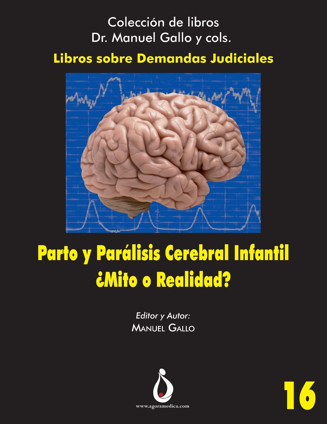 Parto y Parálisis Cerebral Infantil. ¿Mito o Realidad?: Una relación cada vez menos posible