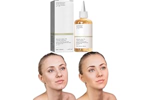 Nmbol Toner Acido Glicolico 7% Soluzione Tonificante Resurfacing Superficie,Soluzione Tonificante All'Acido Glicolico Al 7%,Soluzione Tonificante Ordinaria,Estompe Marques D'acné,100ml