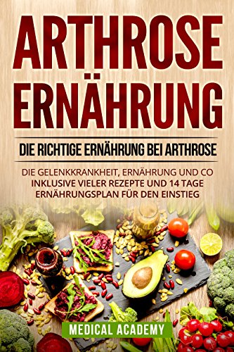 Arthrose Ernährung: Die richtige Ernährung bei Arthrose. Die Gelenkkrankheit, Ernährung und Co. I Arthrose Ernährung: Die richtige Ernährung bei Arthrose. Die Gelenkkrankheit, Ernährung und Co. I