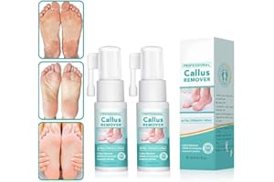 SOUMIEY Professional Callus Remover Extra Strength Spray, Foot Callus Remover Extra Strength Spray, Instant Foot Peeling Spray, Foot Peeling Spray Oil for All Skin Types (2pcs)