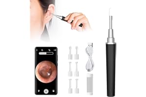 KYAOAYO Otoskop do usuwania woskowiny, inteligentny termostat, WiFi, otoskop, do czyszczenia uszu, 5 milionów pikseli, HD, WiFi, dla dzieci, dorosłych i osób starszych (czarny)