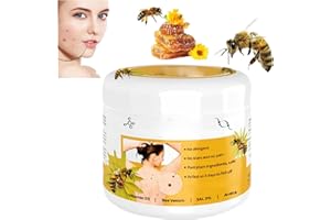 SBYHBHYDS Bienengift 𝐆𝐞𝐠𝐞𝐧 𝐖𝐚𝐫𝐳𝐞𝐧 Creme,Bienengiftsalbe für Arm Taille Füße Bein alle Hauttypen,𝐁𝐞𝐞 𝐕𝐞𝐧𝐨𝐦 Creme für Frauen und Männer (1 Stück)