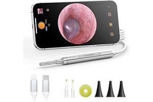 AnyScope Digital Otoscope Compatible with iPhone and Android Devices, HD Ear Camera with Ear Wax Removal Tools, Video Ear Scope Otoscope with Light, Capture Photos and Videos (Silver)