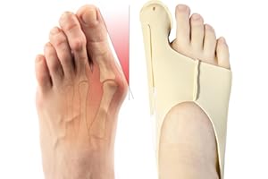 Fantasyon 1 Paire Orthese Hallux Valgus, Réutilisable Correcteur Hallux Valgus Orthese Corrective Redresseur Orteil Séparateur d'Orteil pour Femme et Homme (L)