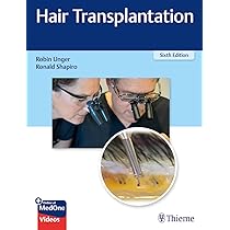 Buy Hair Transplantation 6th Edition Book Online at Low Prices in