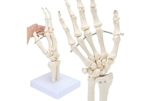 RONTEN Hand Skeleton Model, Showing The Ulna And Radius, The Hand Skeleton With Articulated Joints, Simulating The Natural State of Motion of The Human Hand