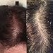 Exesio Shampoo/Hair tonic for hair loss, promotes hair growth. Clinically tested and proven. Natural Botanical extracts. Hair loss treatment for men and women. Suitable for all types of hair types. 280ml