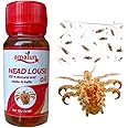 Amalun Lice Removal Oil - Fast-Acting Solution for Head Lice and Scalp Care"
