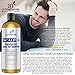 Art Naturals Scalp18 Coal Tar Therapeutic Anti Dandruff Shampoo 473ml - Helps clear symptoms of Psoriasis, Eczema, Itchy Scalp & Dandruff - Made in USA with Natural & Organic Ingredients-Sulfate Free