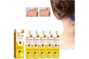 CHISHAYA Tag Recede Bienengift-Behandlungsspray, Bienengift Spray zur Entfernung von Hautflecken, Tag Recede Bee Venom Spray für Alle Hauttypen 20ml