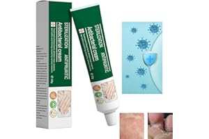 HAWEWE Crème Antifongique à Base De Plantes Pour Les Mains Et Les Pieds, Crème à Base De Plantes Pour éliminer Les Champignons Des Pieds, Crème Pour Les Champignons Des Ongles Des Pieds (1Pcs)
