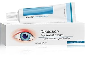 ISBEAUSOLS Chalazion & Blepharitis Treatment Eye Cream - Soothing Relief for Swollen Eyelids, Redness & Irritation - Chalazion Treatment for Stye, Puffiness & Dryness - Gentle Eyelid Cream for Daily Eye Care