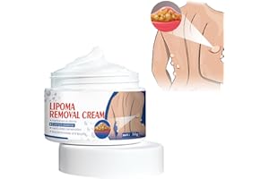 NEXOLLA Lipoma Removal Cream, Crema de Eliminación Ipomas, Crema de Eliminación de Lipomas Vegetales, Crema de Eliminación de Bultos de Lipoma Multifuncional, para Lipomas Benignos de Fibromas
