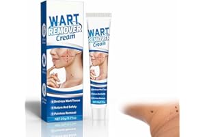 TUKNON Sollievo e Rimozione dalla Verruca Comune E Plantare, Sicuro Per La Pelle Sensibile Unguento Naturale Per Mani, Piedi, Viso, Ascelle, Collo, Grani di Carne