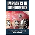 Implants in Orthodontics