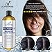 Art Naturals Scalp18 Coal Tar Therapeutic Anti Dandruff Shampoo 473ml - Helps clear symptoms of Psoriasis, Eczema, Itchy Scalp & Dandruff - Made in USA with Natural & Organic Ingredients-Sulfate Free