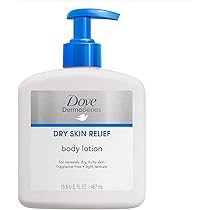 dove lotion for eczema