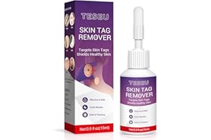 TESEU Wart Remover, Wart Removal, Verruca Remover, Fast Effective Skin Tag Removal for Common Warts, Plantar Warts, Corn and Calluse, Suitable for All Skin