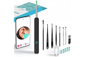 LONNALEE Kit di rimozione della cera con 6 cucchiai per le orecchie. Set da 8 pezzi con fotocamera e luce. Strumento per la rimozione della cera per la pulizia delle orecchie Wi-Fi, Ear Cleaner impermeabile