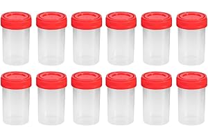 Hemobllo Urinbecher Probe Tassen Urinprobenbecher Kunststoffbecher mit Schraubdeckel 60ml 25 Stück (Zufällige Farbe)