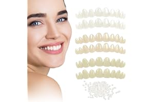 KFHENSOMR tooth repair kit broken teeth false moldable filling permanent denture replacement missing cavity filler instant smile temporary temp chipped care shades covers diy beads hole flipper wax plastic gap