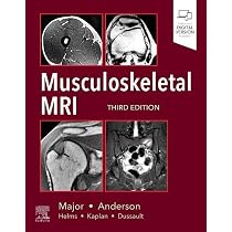MRI In Orthopaedics And Sports 〜2冊 Buy Magnetic Resonance Imaging in Orthopedics & Sports Medicine