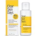 Clear Skin Days 4% BHA & 4% PHA Pore Refining Solution - Liquid Exfoliant Serum for Reduced Pore Appearance, Breakout Prevention, & Blackhead Control - Acid Combination Treatment - 50ml