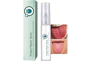 SEMECOMER Tongue Repair Spray, Oral Antibacterial Spray, Instant Dry Mouth Relief, Fissured Tongue-Relief Sprays, Mint Breath Freshener Sprays, Tongue Repair-Spray for Dryness, White Coating and Bad Breath